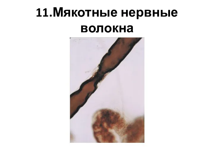 11.Мякотные нервные волокна