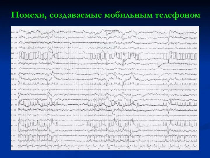 Помехи, создаваемые мобильным телефоном