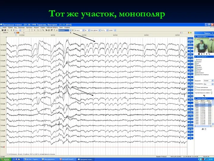 Тот же участок, монополяр