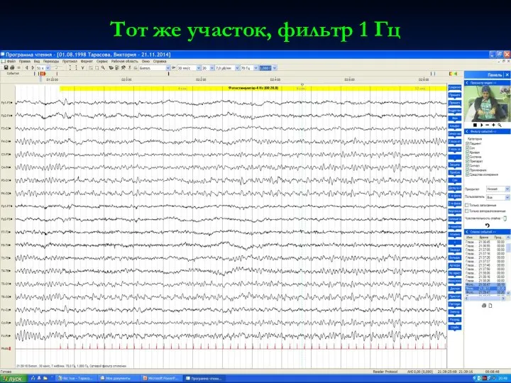 Тот же участок, фильтр 1 Гц