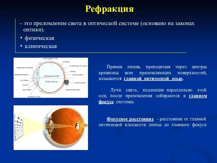 – это преломление света в оптической системе (основано на законах оптики). физическая