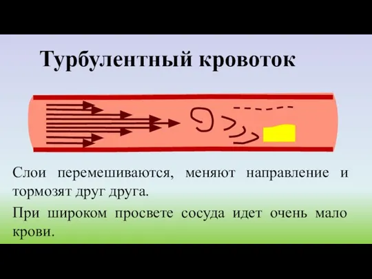 Турбулентный кровоток Слои перемешиваются, меняют направление и тормозят друг друга. При широком