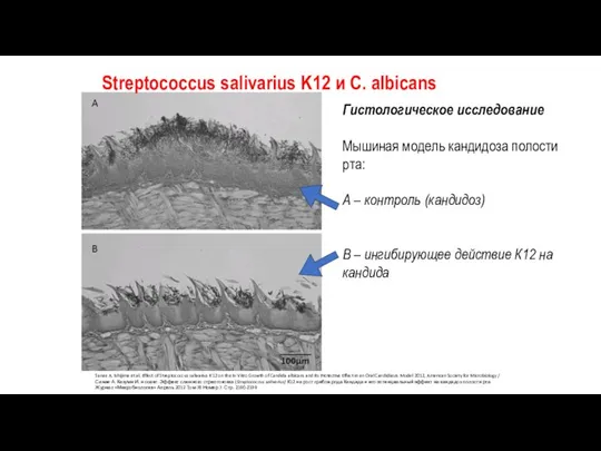 Streptococcus salivarius K12 и C. albicans Гистологическое исследование Мышиная модель кандидоза полости