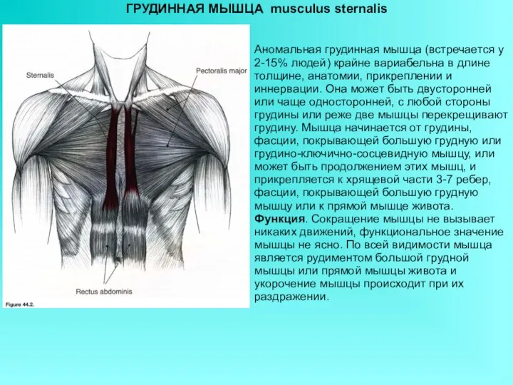 ГРУДИННАЯ МЫШЦА musculus sternalis Аномальная грудинная мышца (встречается у 2-15% людей) крайне