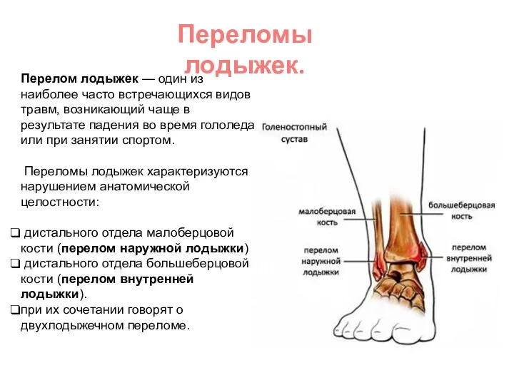Переломы лодыжек. Перелом лодыжек — один из наиболее часто встречающихся видов травм,
