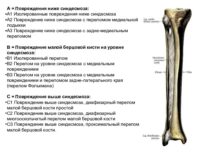 А = Повреждения ниже синдесмоза: А1 Изолированные повреждения ниже синдесмоза А2 Повреждение