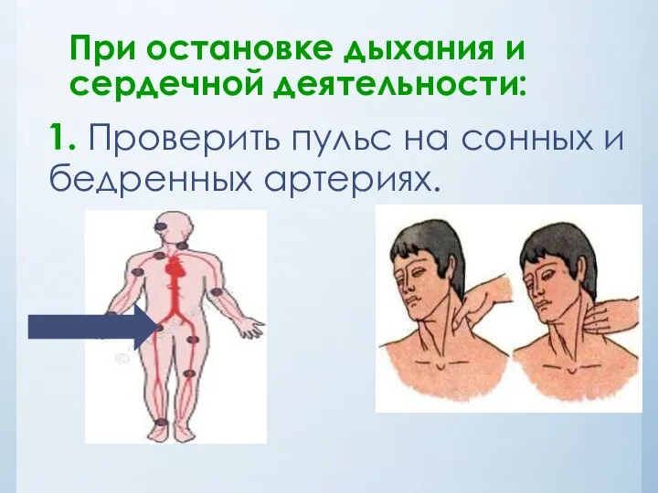 При остановке дыхания и сердечной деятельности: 1. Проверить пульс на сонных и бедренных артериях.