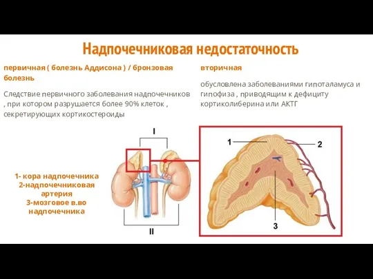 Надпочечниковая недостаточность первичная ( болезнь Аддисона ) / бронзовая болезнь Следствие первичного