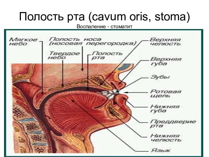 Полость рта (cavum oris, stoma) Воспаление - стоматит