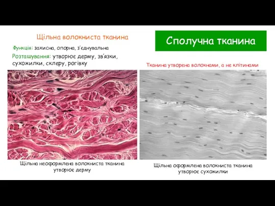 Сполучна тканина Щільна волокниста тканина Функція: захисна, опорна, з’єднувальна Розташування: утворює дерму,