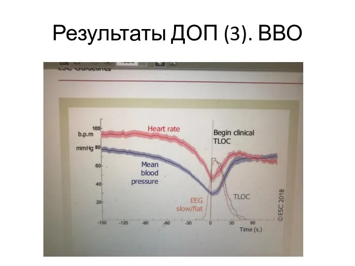 Результаты ДОП (3). ВВО