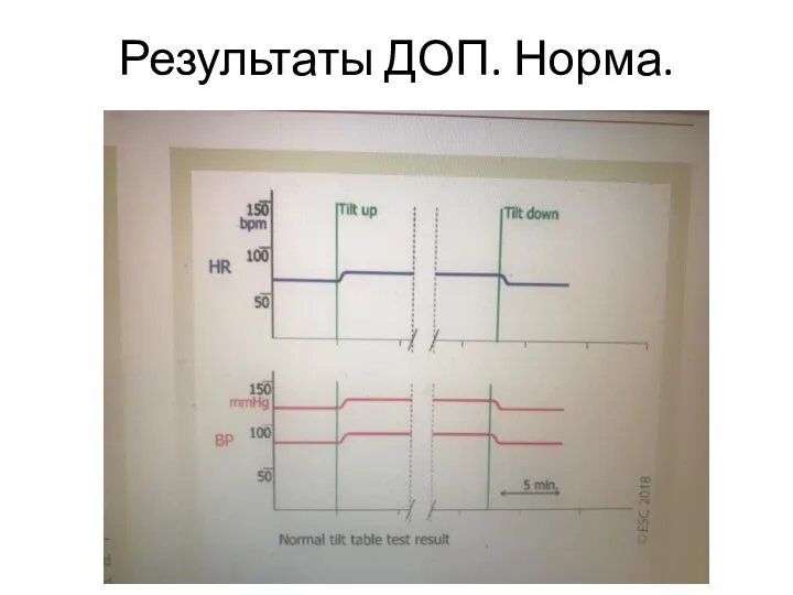 Результаты ДОП. Норма.