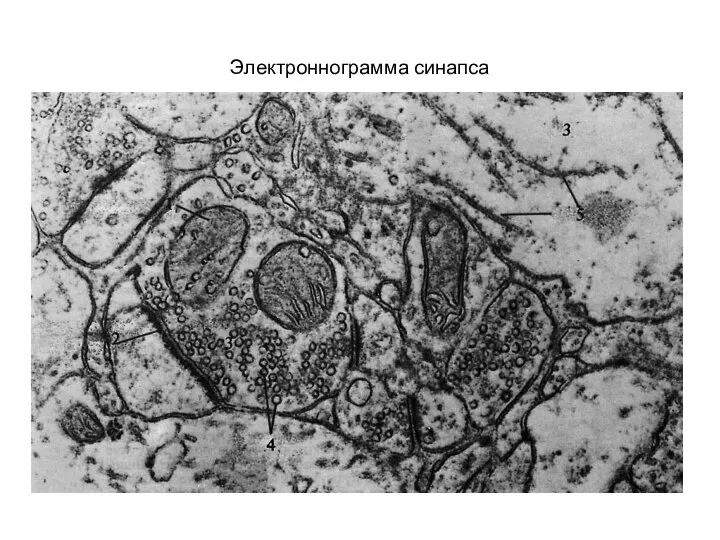 Электроннограмма синапса