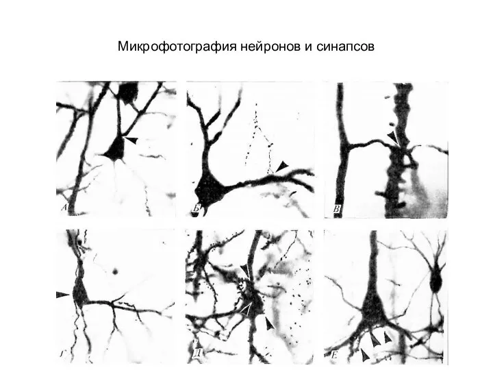 Микрофотография нейронов и синапсов
