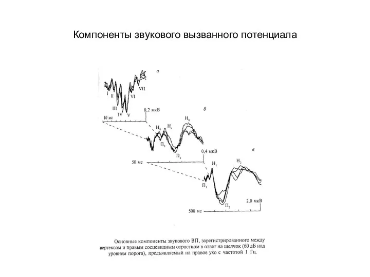 Компоненты звукового вызванного потенциала