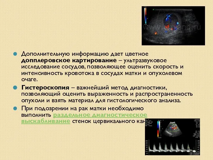 Дополнительную информацию дает цветное допплеровское картирование – ультразвуковое исследование сосудов, позволяющее оценить