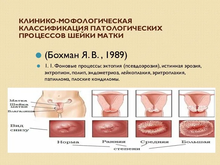 КЛИНИКО-МОФОЛОГИЧЕСКАЯ КЛАССИФИКАЦИЯ ПАТОЛОГИЧЕСКИХ ПРОЦЕССОВ ШЕЙКИ МАТКИ (Бохман Я. В. , 1989) 1.