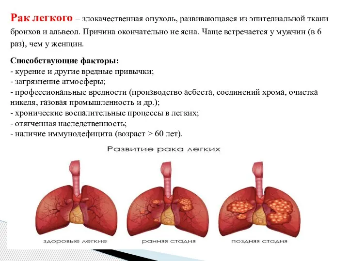 Рак легкого – злокачественная опухоль, развивающаяся из эпителиальной ткани бронхов и альвеол.