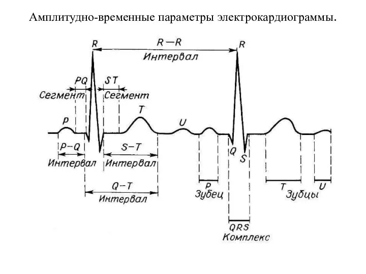 Амплитудно-временные параметры электрокардиограммы.