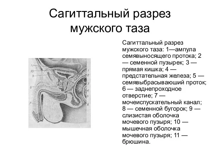 Сагиттальный разрез мужского таза Сагиттальный разрез мужского таза: 1—ампула семявыносящего протока; 2