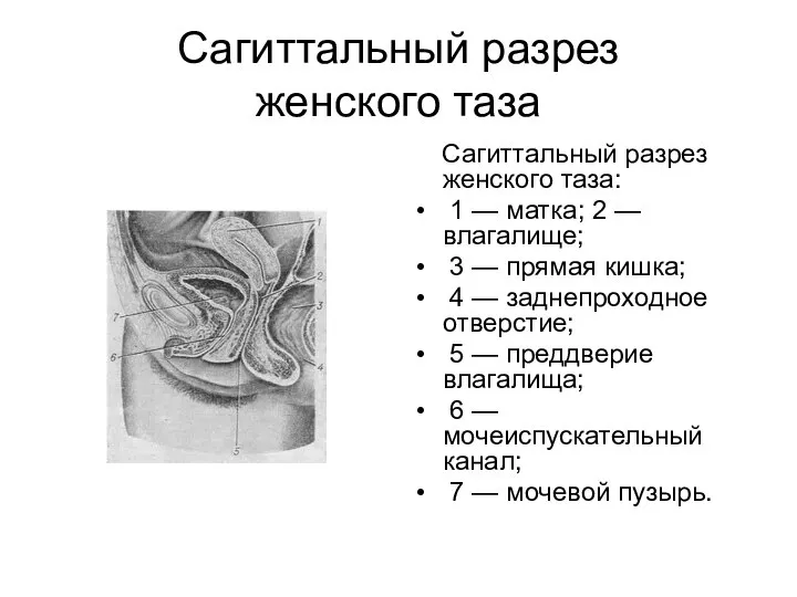 Сагиттальный разрез женского таза Сагиттальный разрез женского таза: 1 — матка; 2