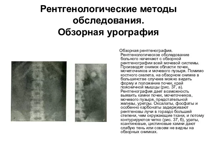 Рентгенологические методы обследования. Обзорная урография Обзорная рентгенография. Рентгенологическое обследование больного начинают с