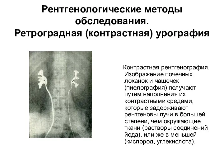 Рентгенологические методы обследования. Ретроградная (контрастная) урография Контрастная рентгенография. Изображение почечных лоханок и