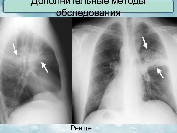 Дополнительные методы обследования Рентген