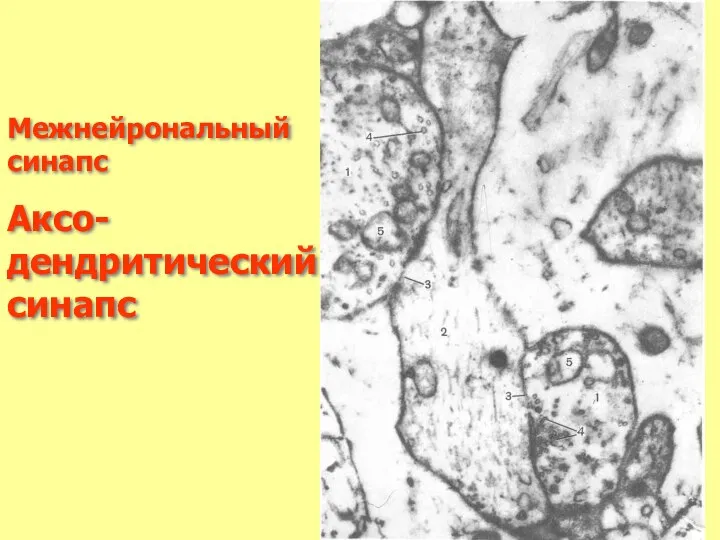 Межнейрональный синапс Аксо-дендритический синапс