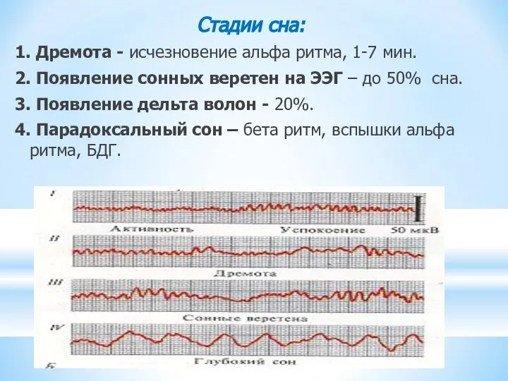 Стадии сна: 1. Дремота - исчезновение альфа ритма, 1-7 мин. 2. Появление