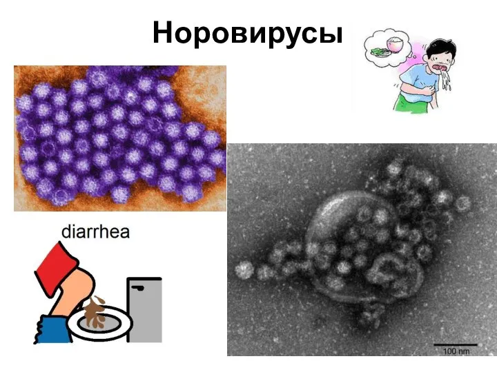 Норовирусы