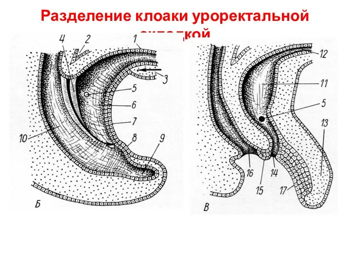 Разделение клоаки уроректальной складкой