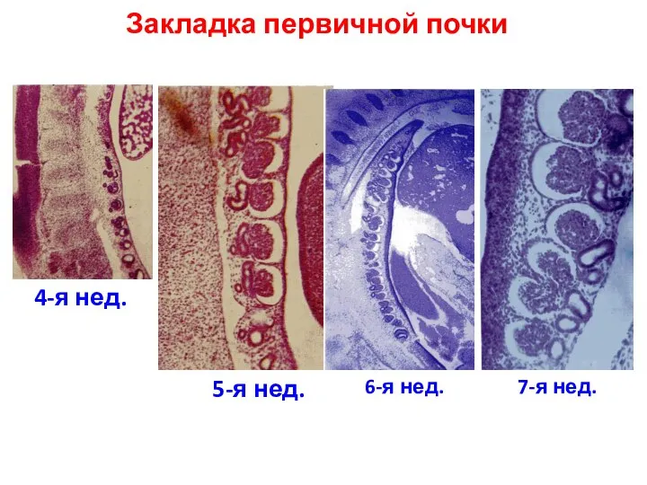 Закладка первичной почки 4-я нед. 5-я нед. 6-я нед. 7-я нед.