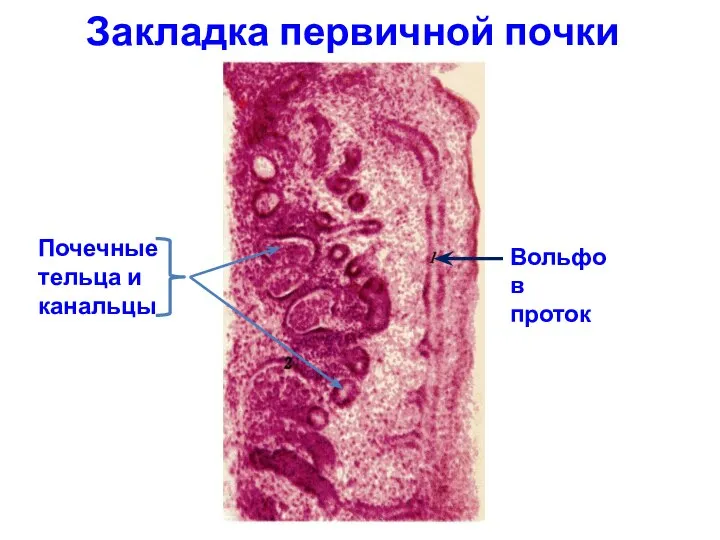 Закладка первичной почки Вольфов проток Почечные тельца и канальцы