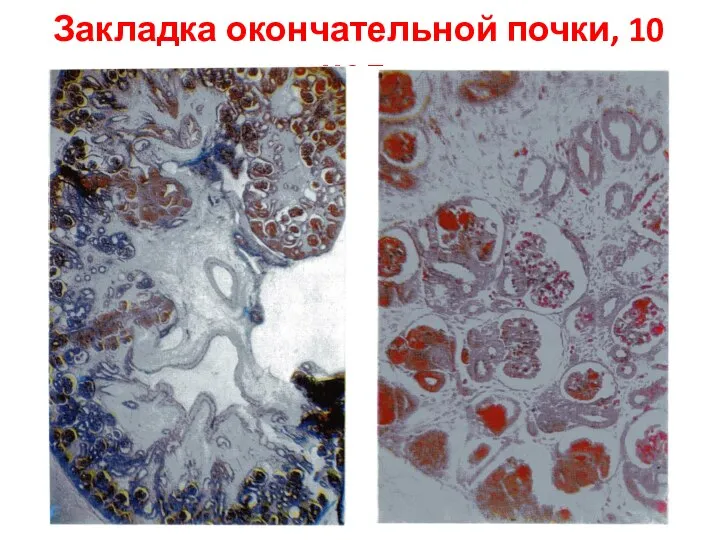 Закладка окончательной почки, 10 нед.