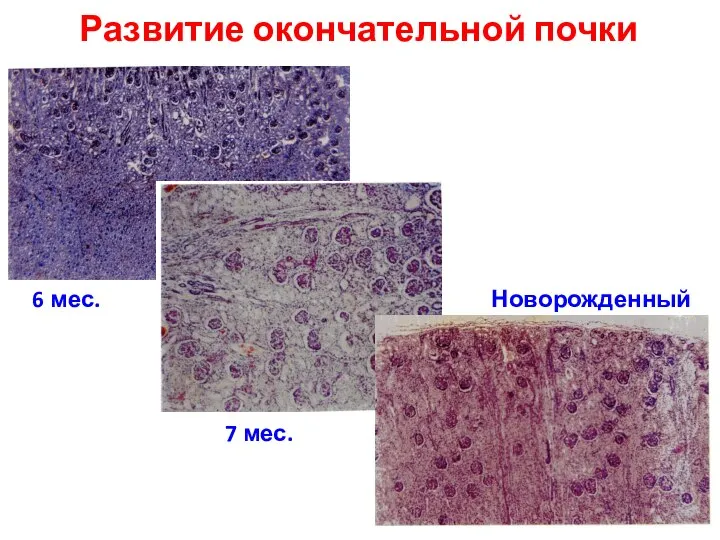 Развитие окончательной почки 6 мес. 7 мес. Новорожденный