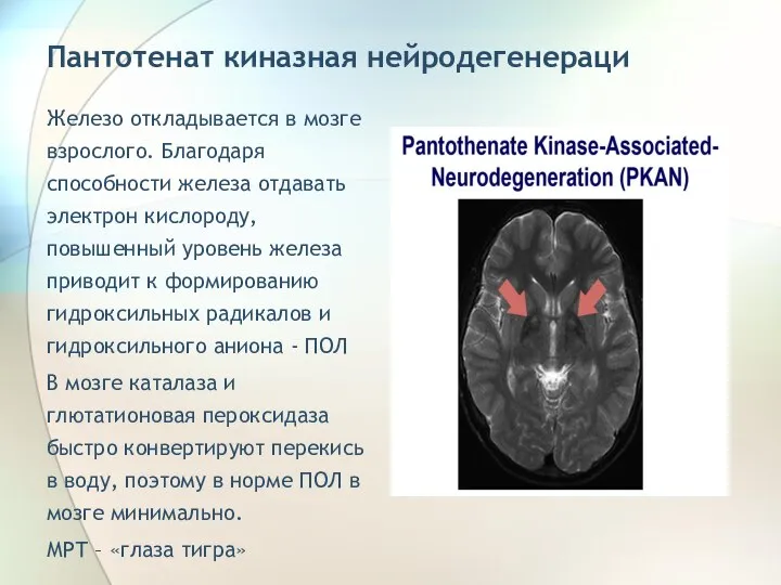 Пантотенат киназная нейродегенераци Железо откладывается в мозге взрослого. Благодаря способности железа отдавать