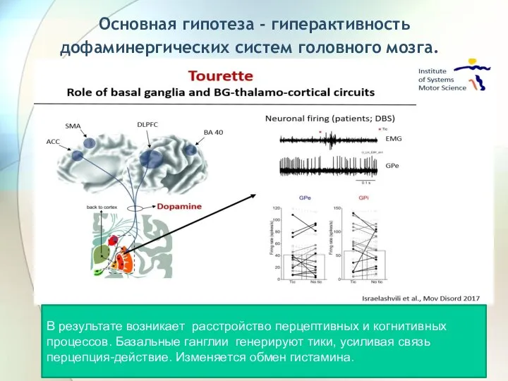Основная гипотеза - гиперактивность дофаминергических систем головного мозга. В результате возникает расстройство