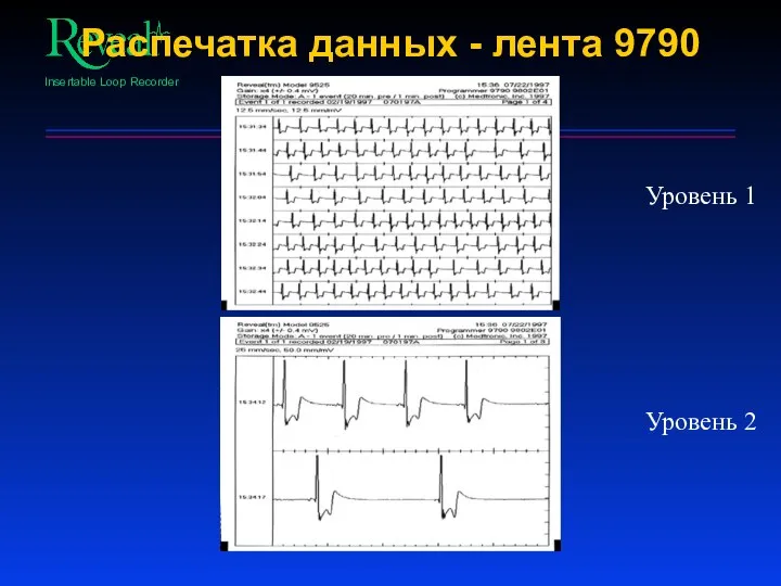 Распечатка данных - лента 9790 Уровень 1 Уровень 2