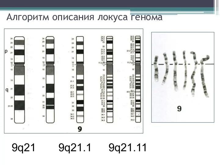 Алгоритм описания локуса генома 9q21 9q21.1 9q21.11