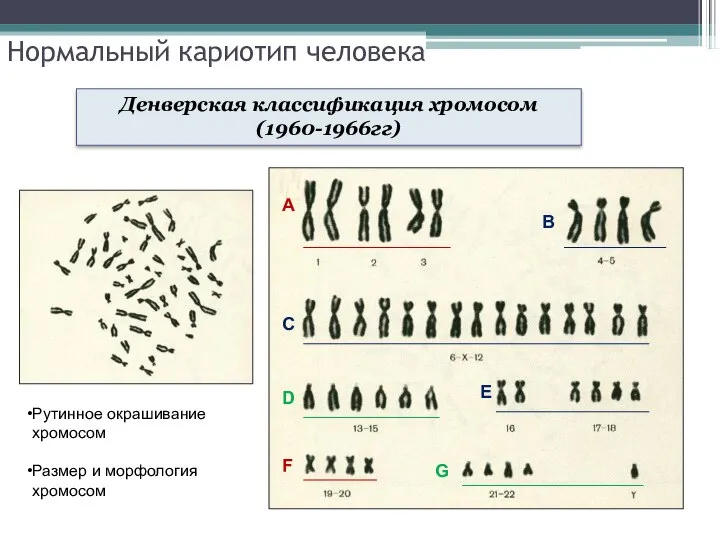 Нормальный кариотип человека Денверская классификация хромосом (1960-1966гг)