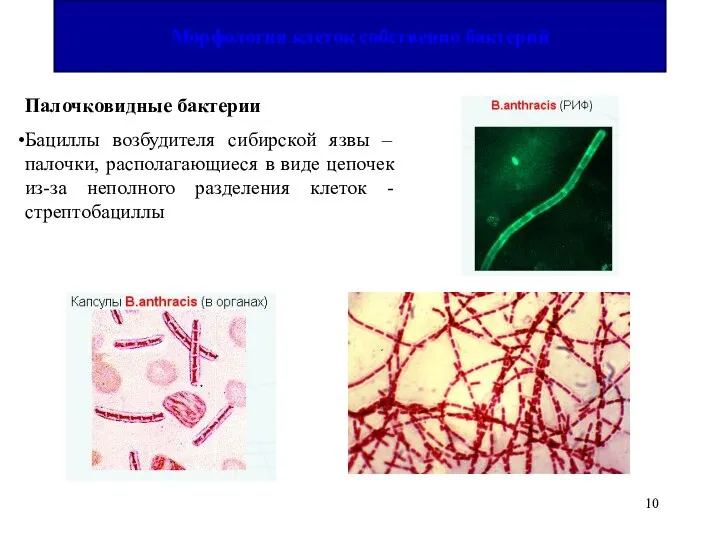 Палочковидные бактерии Бациллы возбудителя сибирской язвы – палочки, располагающиеся в виде цепочек
