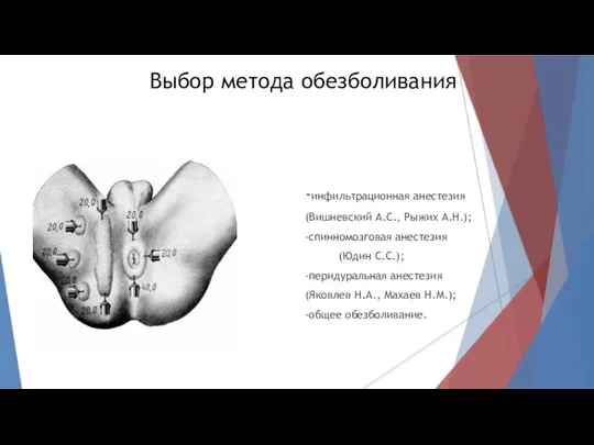 Выбор метода обезболивания -инфильтрационная анестезия (Вишневский А.С., Рыжих А.Н.); -спинномозговая анестезия (Юдин