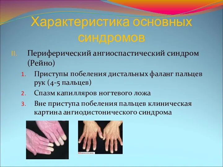 Характеристика основных синдромов Периферический ангиоспастический синдром (Рейно) Приступы побеления дистальных фаланг пальцев