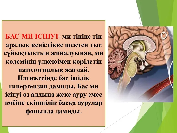 БАС МИ ІСІНУІ- ми тініне тін аралық кеңістікке шектен тыс сұйықтықтың жиналуынан,