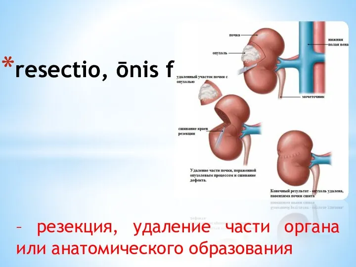 – резекция, удаление части органа или анатомического образования resectio, ōnis f