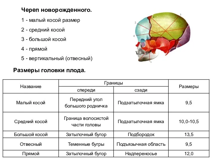 Череп новорожденного. 1 - малый косой размер 2 - средний косой 3