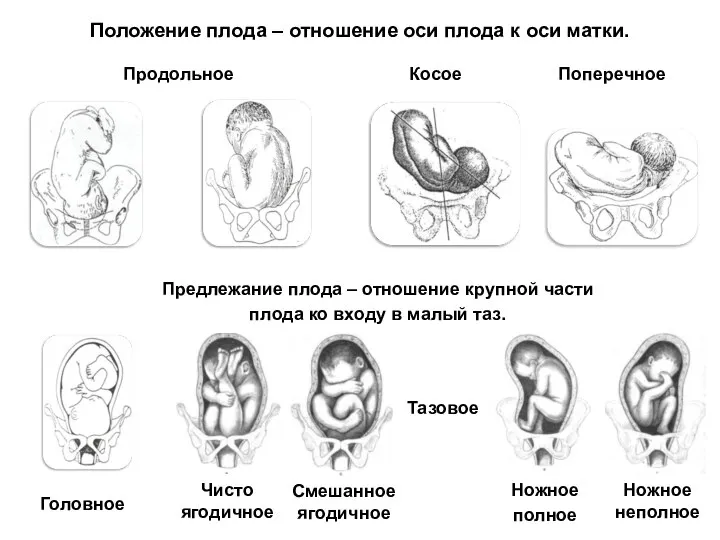 Положение плода – отношение оси плода к оси матки. Предлежание плода –