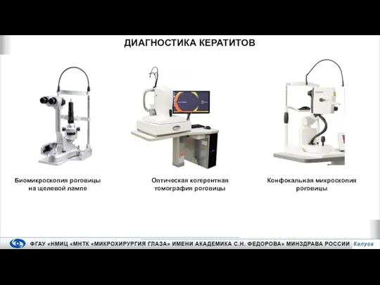 ДИАГНОСТИКА КЕРАТИТОВ Биомикроскопия роговицы на щелевой лампе Оптическая когерентная томография роговицы Конфокальная микроскопия роговицы