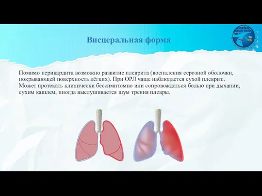 Помимо перикардита возможно развитие плеврита (воспаления серозной оболочки, покрывающей поверхность лёгких). При